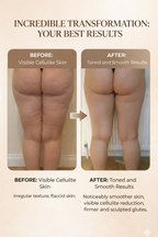 Suction Pro® SculptGlow™ – Firmer, More Toned Skin✨