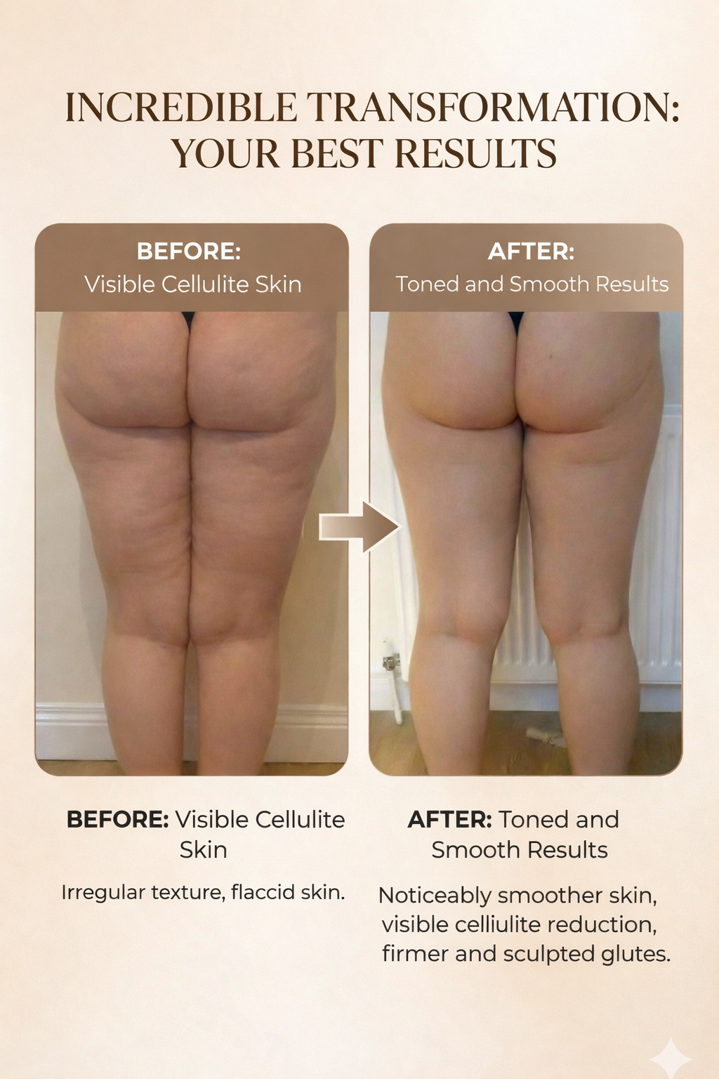 Suction Pro® SculptGlow™ – Firmer, More Toned Skin✨